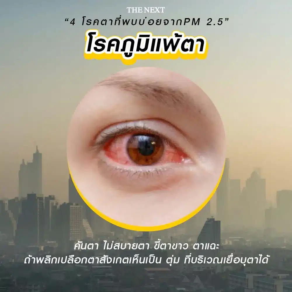 โรคภูมิแพ้ตา