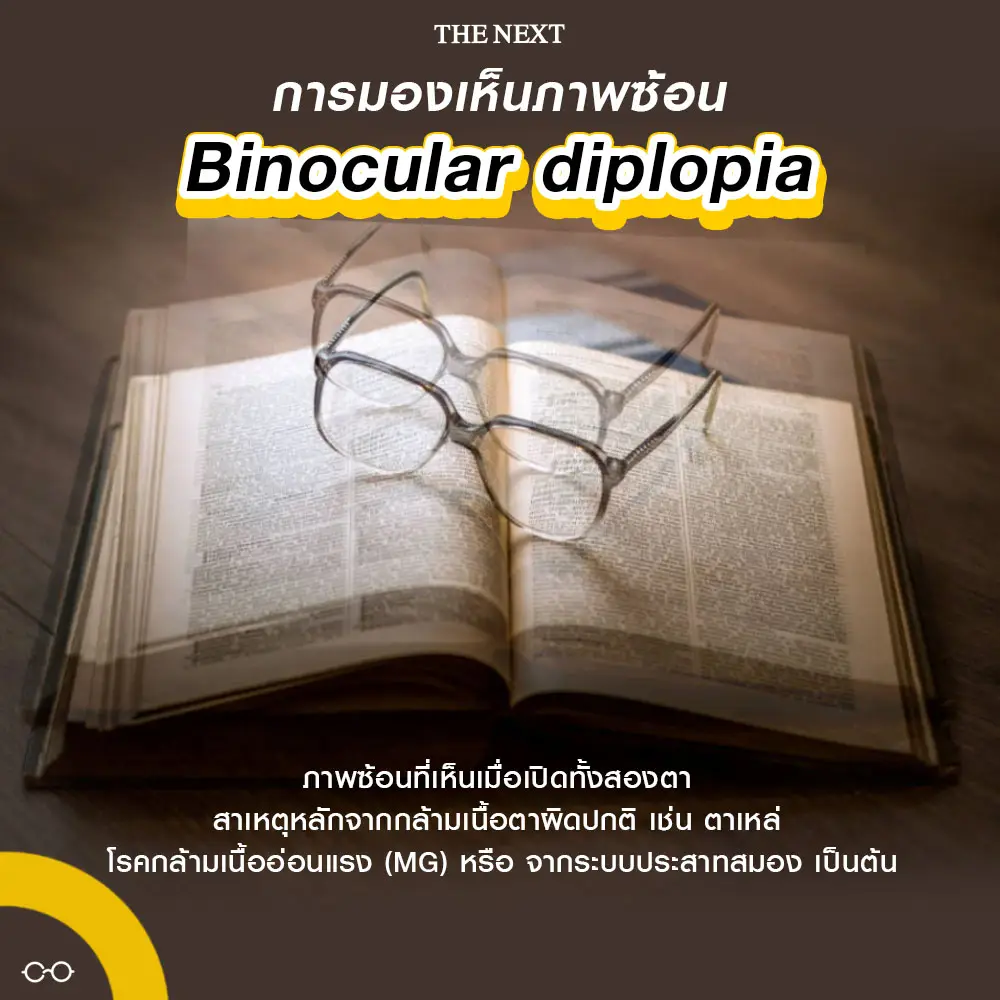 การมองเห็นภาพซ้อน Binocular diplopia