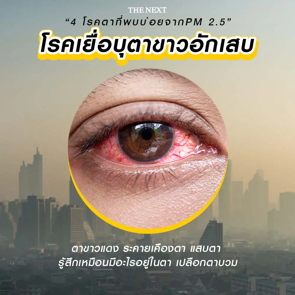 โรคเยื่อบุตาขาวอักเสบ