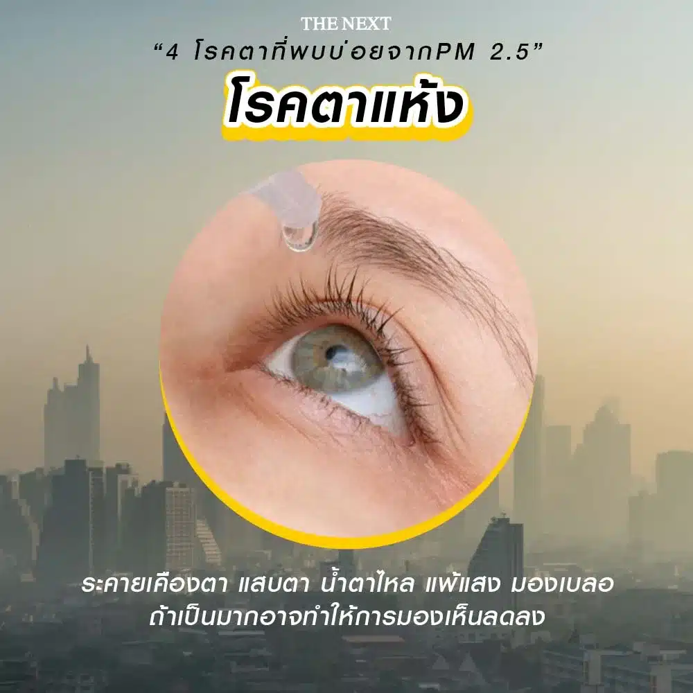 โรคตาแห้ง