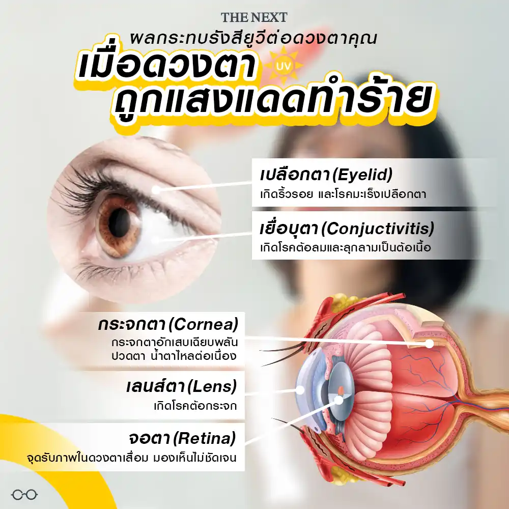ดวงตาถูกสงแดดทำร้าย อันตรายแค่ไหน