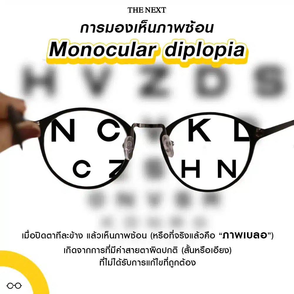 การมองเห็นภาพซ้อน Monocular diplopia