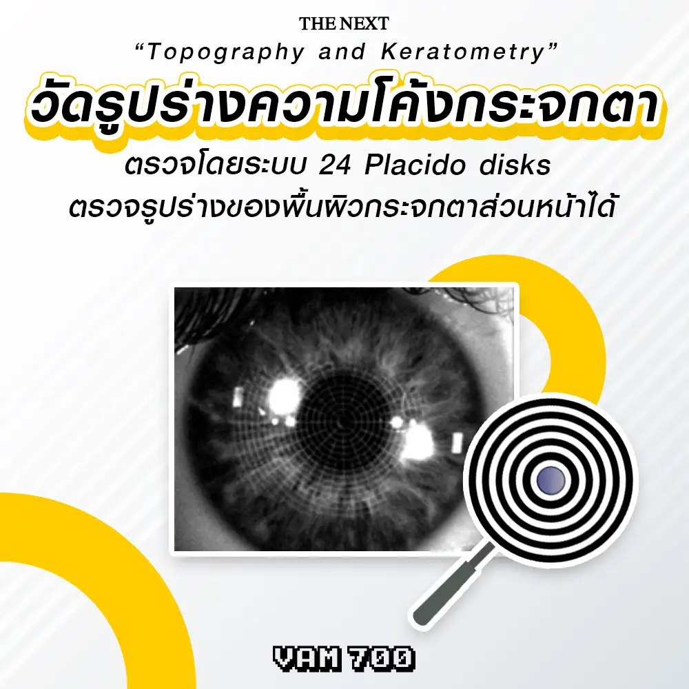 วัดรูปร่างความโค้งของกระจกตา