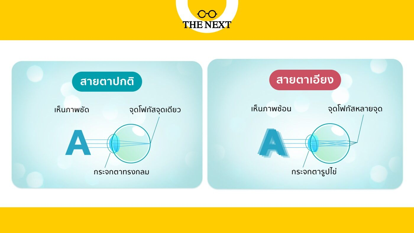 ความผิดปกติของสายตาเอียง